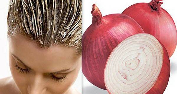 Creative Uses of Onion as Natural Home Remedies --> help your hair grow 2 times faster