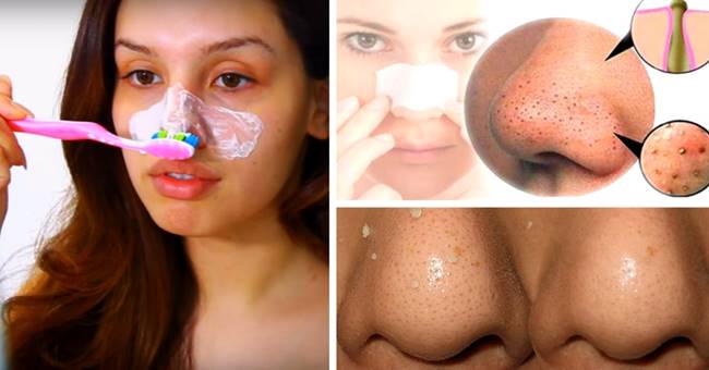 Beauty Tip Tuesday's: Let's Remove those Blackheads